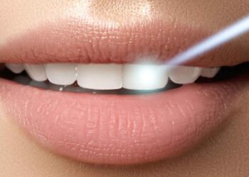 Flash-отбеливание зубов: сияющая улыбка в считанные минуты